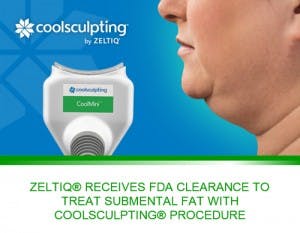 Coolsculpting-mini-double-chin-nyc-300x233-1.jpg